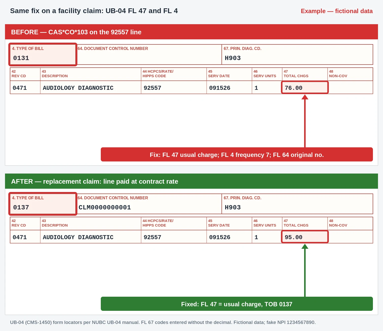 CO-103 UB-04 claim form revenue line 0471 for 92557 with FL 47 total charges restored to the usual fee