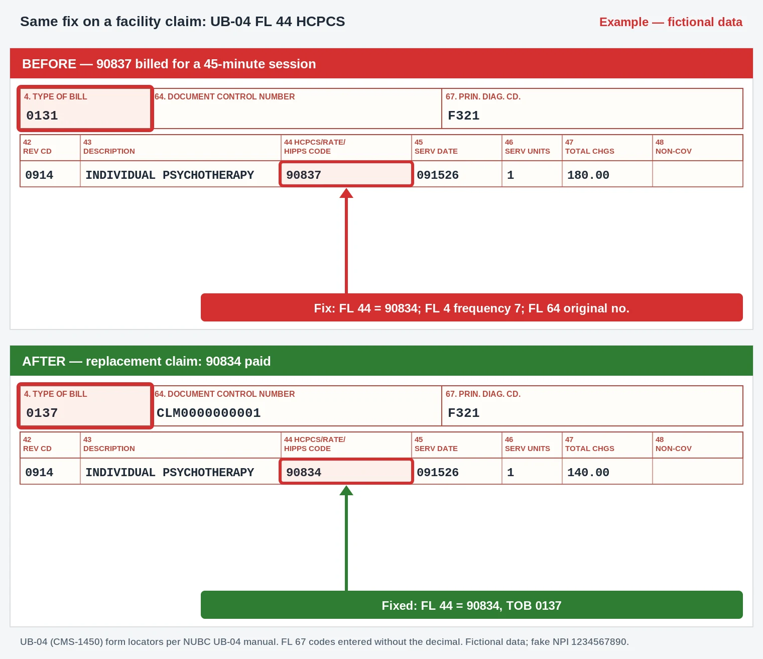 CO-152 Denial Code (CARC 152) 2026: Information Submitted Does Not Support This Length of Service 4 CO-152 UB-04 claim form revenue code 0914 psychotherapy line with FL 44 changed from 90837 to 90834