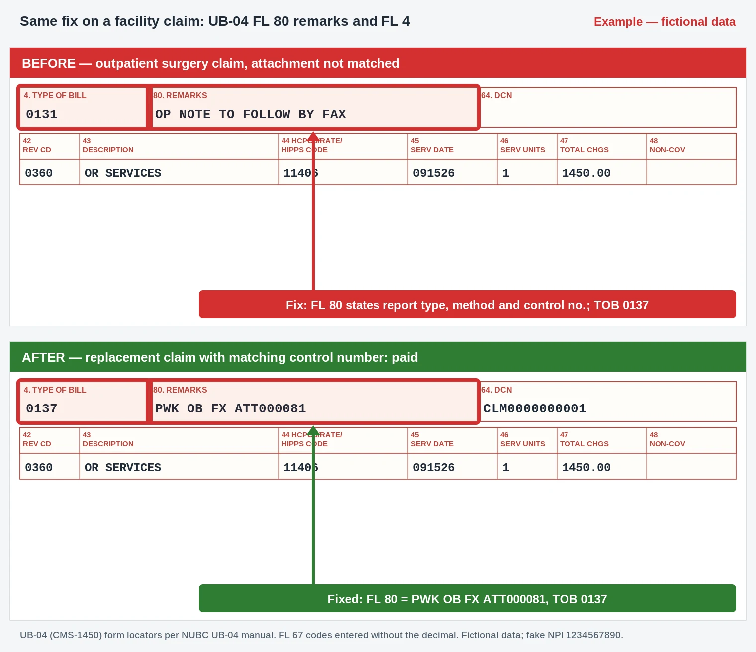 CO-163 Denial Code (CARC 163) 2026: Attachment or Documentation Referenced on the Claim Was Not Received 4 UB-04 outpatient surgery claim with FL 80 remarks listing the attachment control number and type of bill 0137