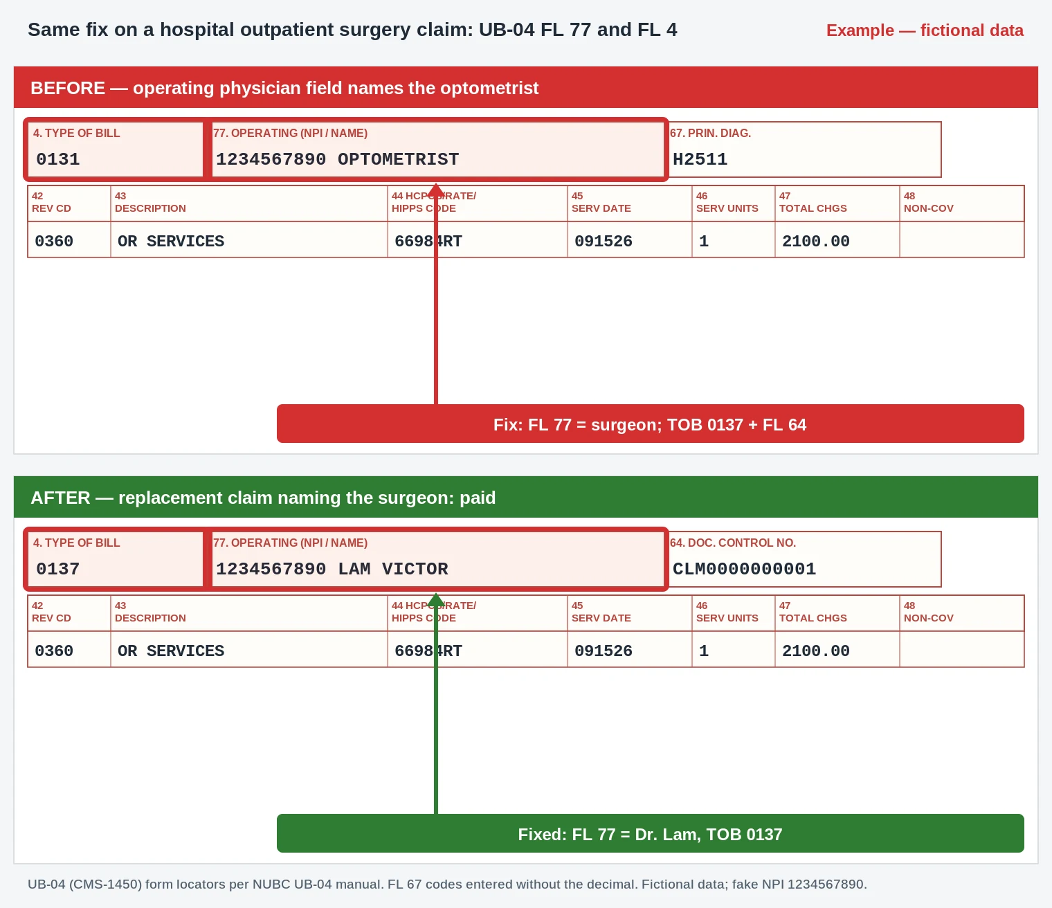 CO-185 UB-04 surgery claim with FL 77 operating physician corrected to the cataract surgeon