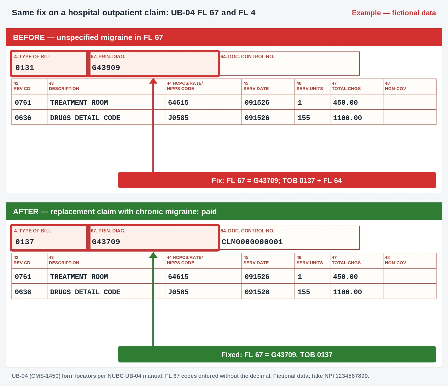 CO-188 UB-04 claim form with FL 67 principal diagnosis corrected to G43709 for J0585 and 64615