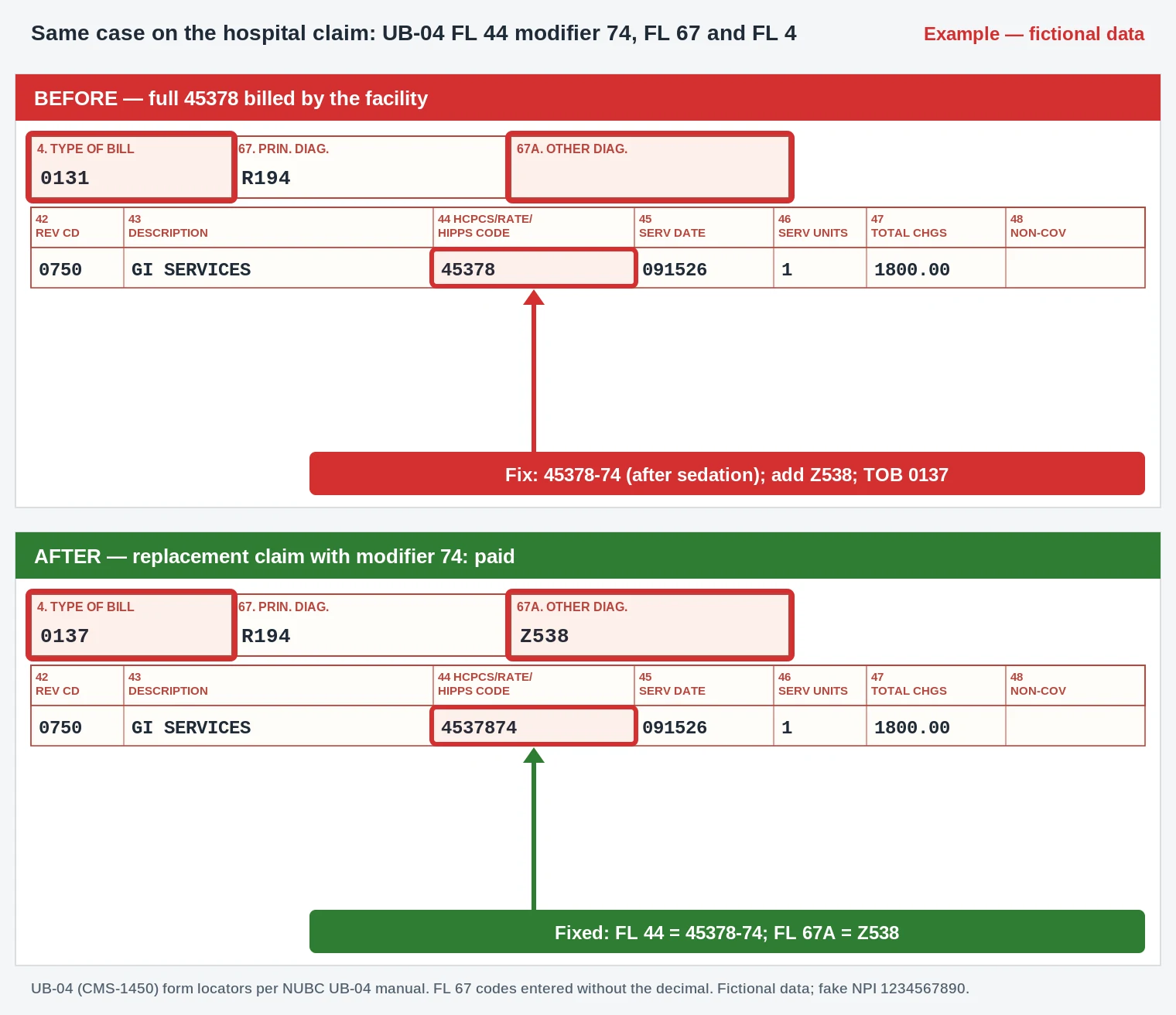 CO-203 UB-04 claim form adding facility modifier 74 to 45378 on revenue code 0750 with Z538