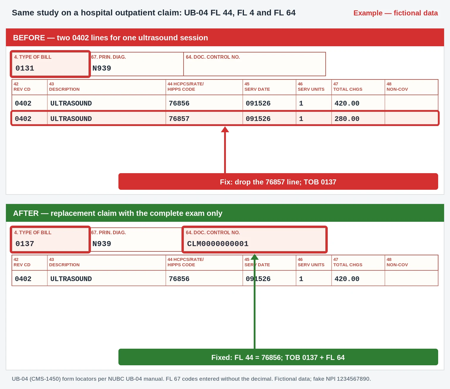 CO-231 UB-04 claim form removing the 76857 line under revenue code 0402 in FL 44 on a 0137 bill