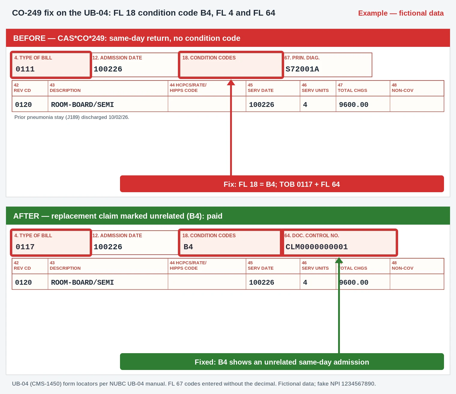 CO-249 UB-04 claim form adding condition code B4 in FL 18 for an unrelated same-day readmission