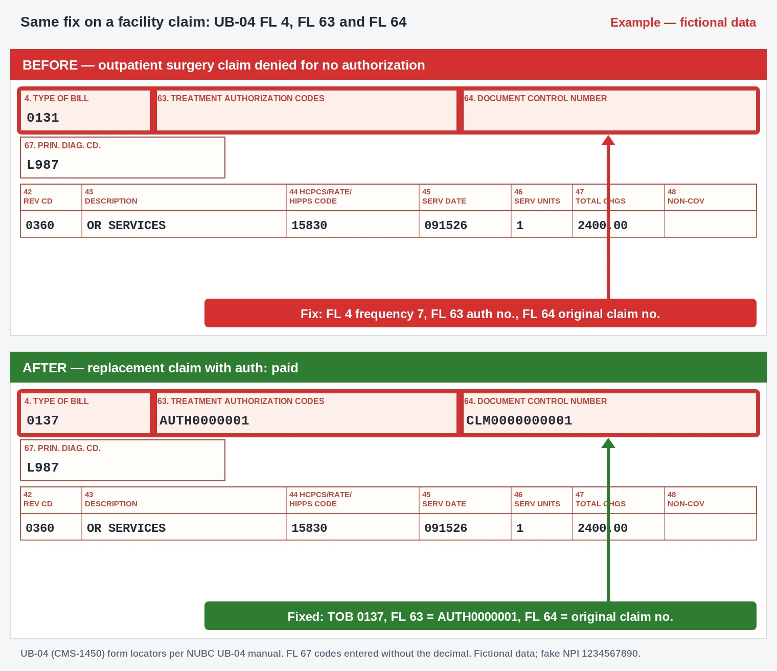 OA-101 Reason Code (CARC 101) 2026: Predetermination, Not Payment 4 OA-101 UB-04 claim form for the OA-101 surgery showing FL 4 type of bill 0137 and FL 63 authorization code