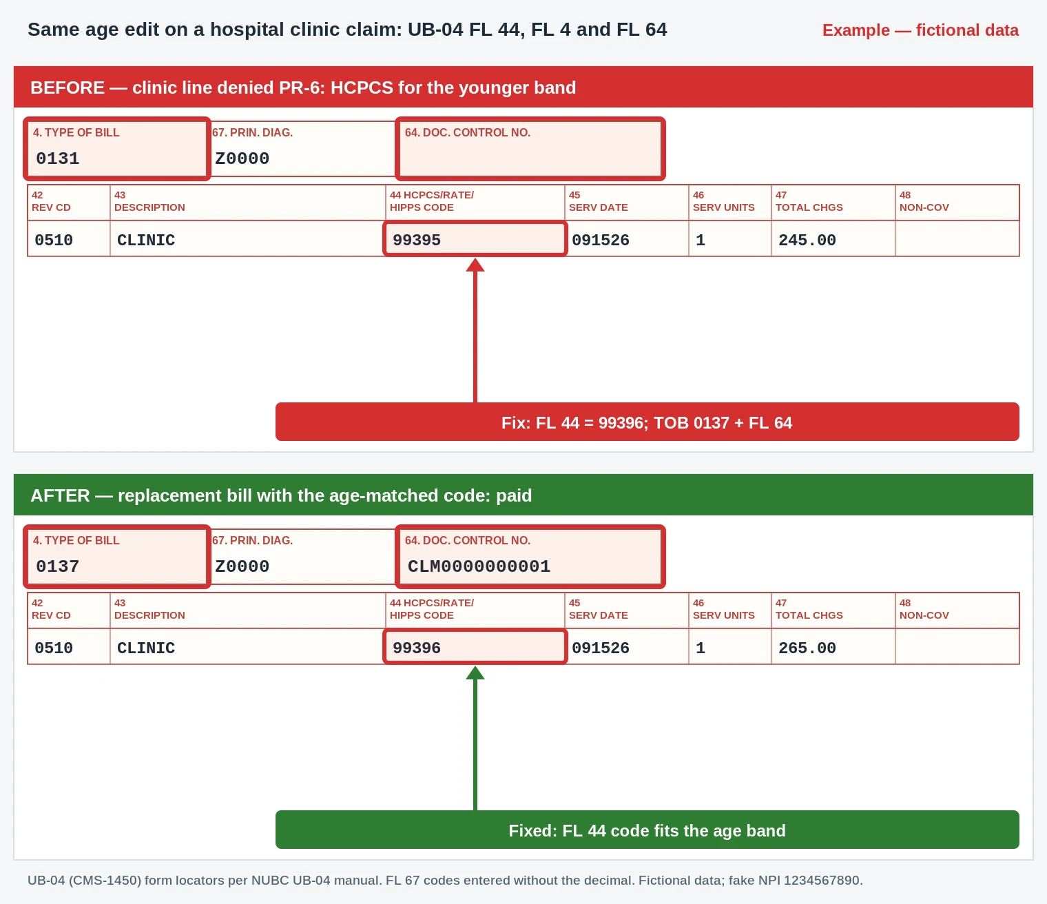 PR-6 Denial Code (CARC 6) 2026: Age Mismatch Billed to the Patient 4 Hospital clinic UB-04 sample replacing HCPCS 99395 with 99396 in FL 44 under bill type 0137